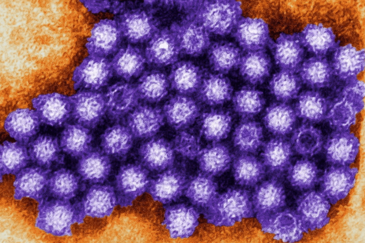 Norovirus