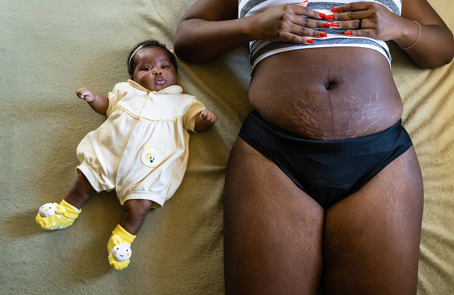 FOTOS: la vida real (y sin filtros) de mujeres después del parto