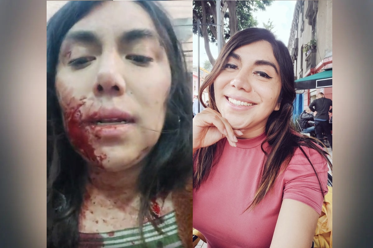 Foto: captura/Facebook | La activista transexual Natalia Lane fue acuchillada en la nuca en un hotel de CDMX.