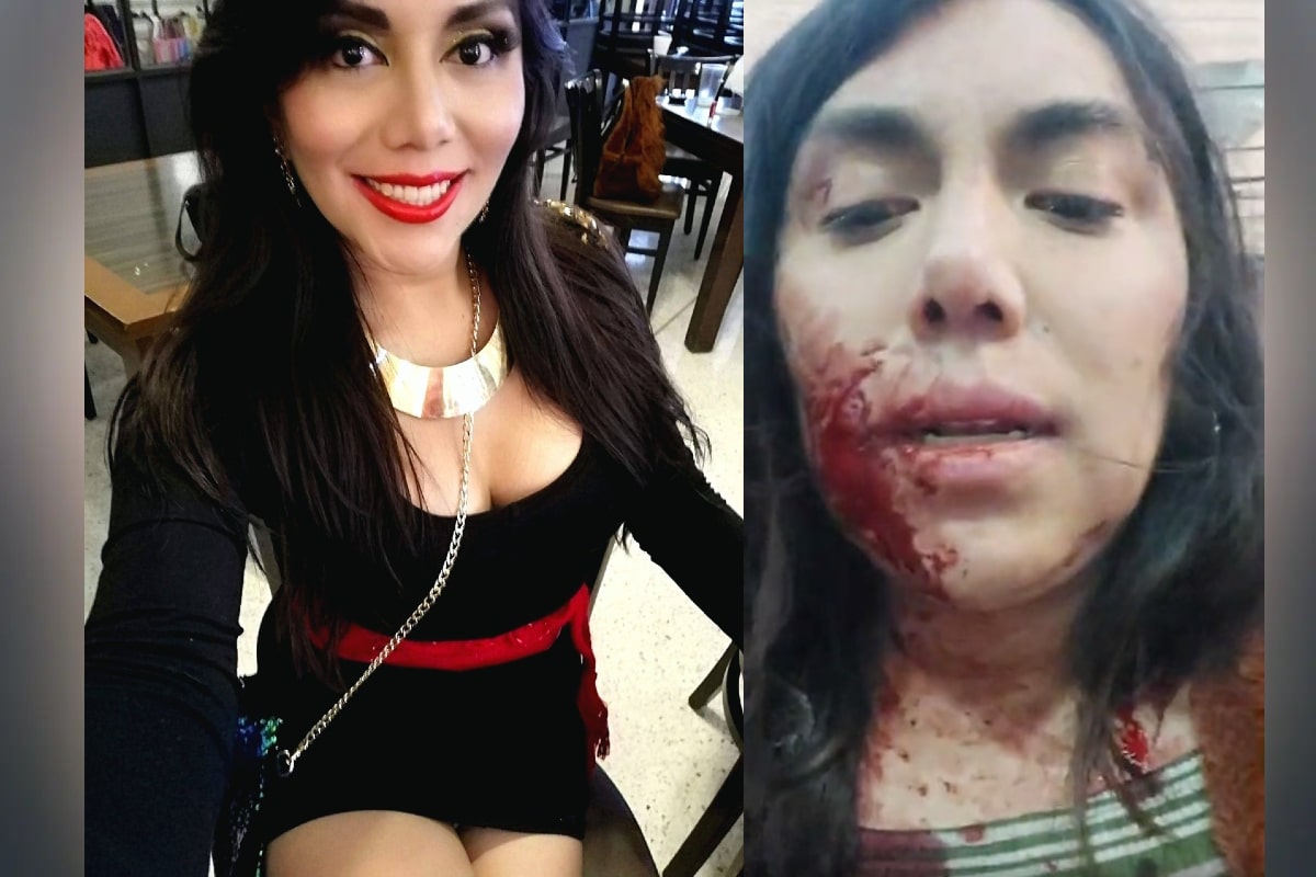 Foto: redes/captura | La activista transexual Natalia Lane fue acuchillada.