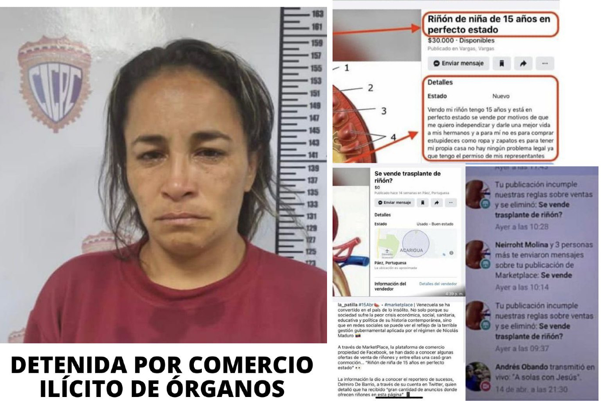 La mujer ofrecía el órgano en venta a través de Facebook.