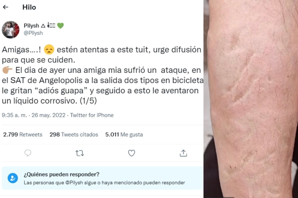 Foto:Captura de pantalla|“Adiós, guapa”: Dos sujetos atacan a mujer con ácido sulfúrico