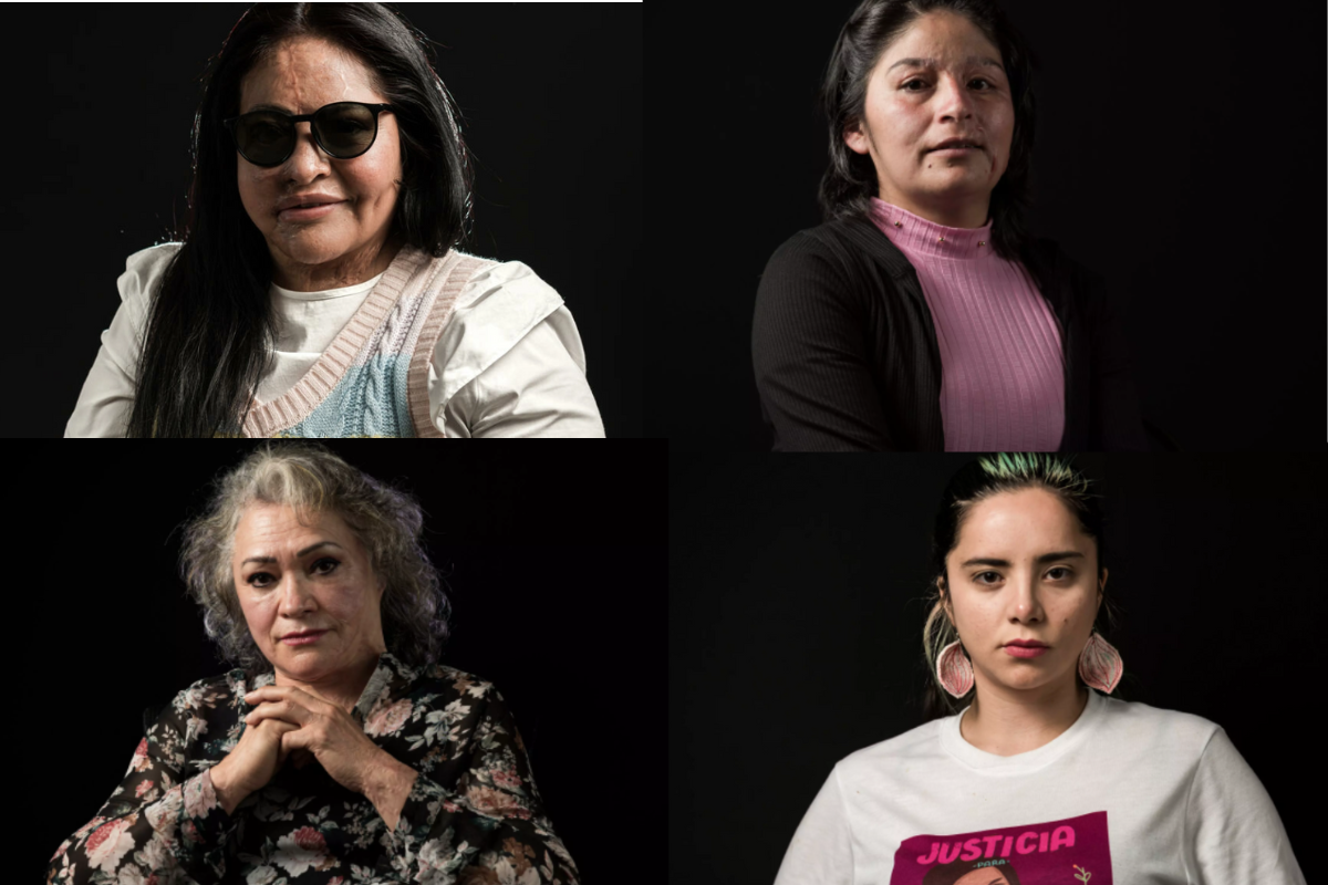 Foto: AFP | Ayudar para sanar: las mexicanas víctimas de la "violencia ácida"