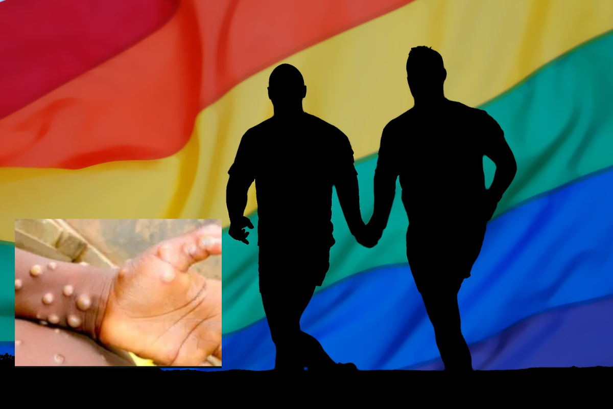 Foto: Pixabay | Reino Unido quiere vacunar contra la viruela del mono a gays "de riesgo"