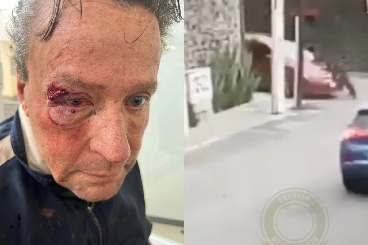 Foto: | ¿Cómo terminó Alfredo Adame agredido tras balacera en Tepepan? Te contamos lo que se sabe