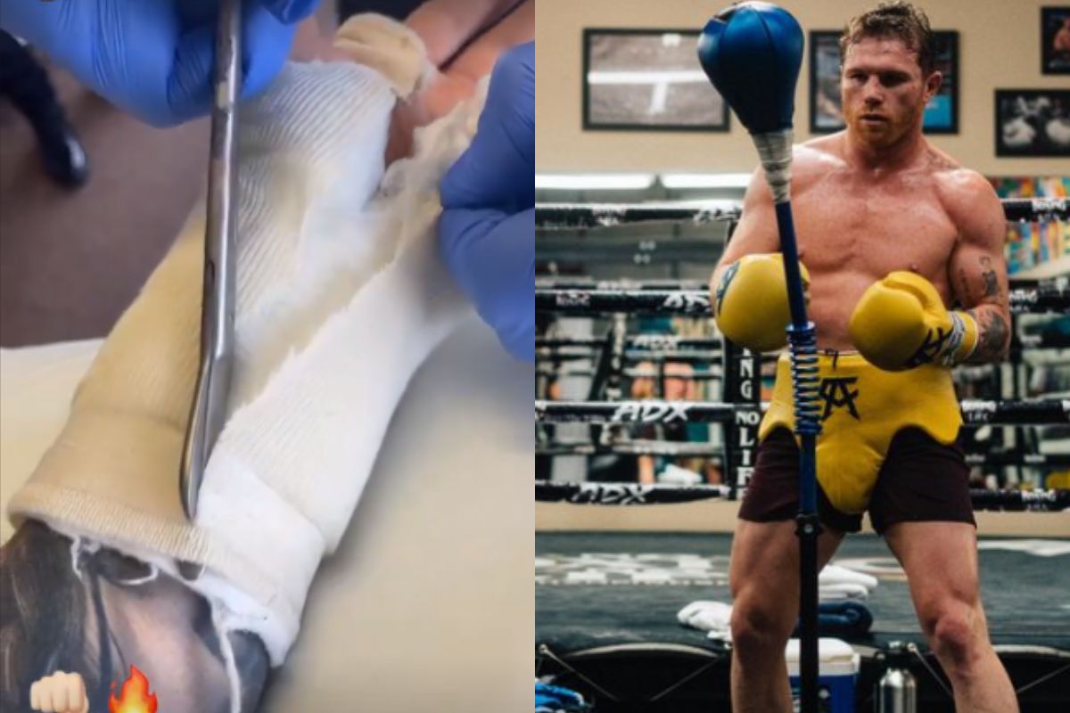 Foto:Instagram/@canelo|¿Listo para volver? El “Canelo” muestra su recuperación tras ser operado de la muñeca