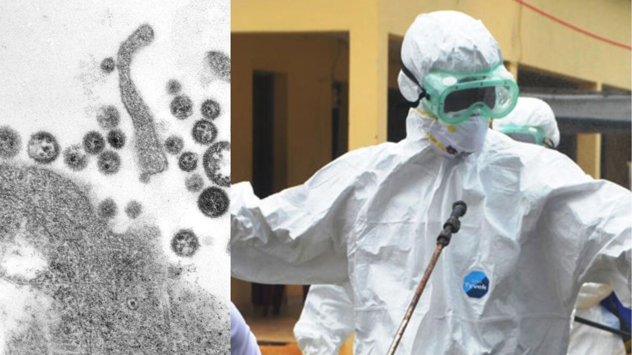 La fiebre de Lassa es una enfermedad ocasionada por el virus de Lassa que se encuentra principalmente en África Occidental.