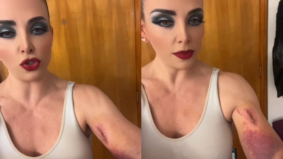 La actriz y cantante Lisset cayó a una coladera en calles de la Ciudad de México y quedó con algunas heridas que expuso en redes sociales.
