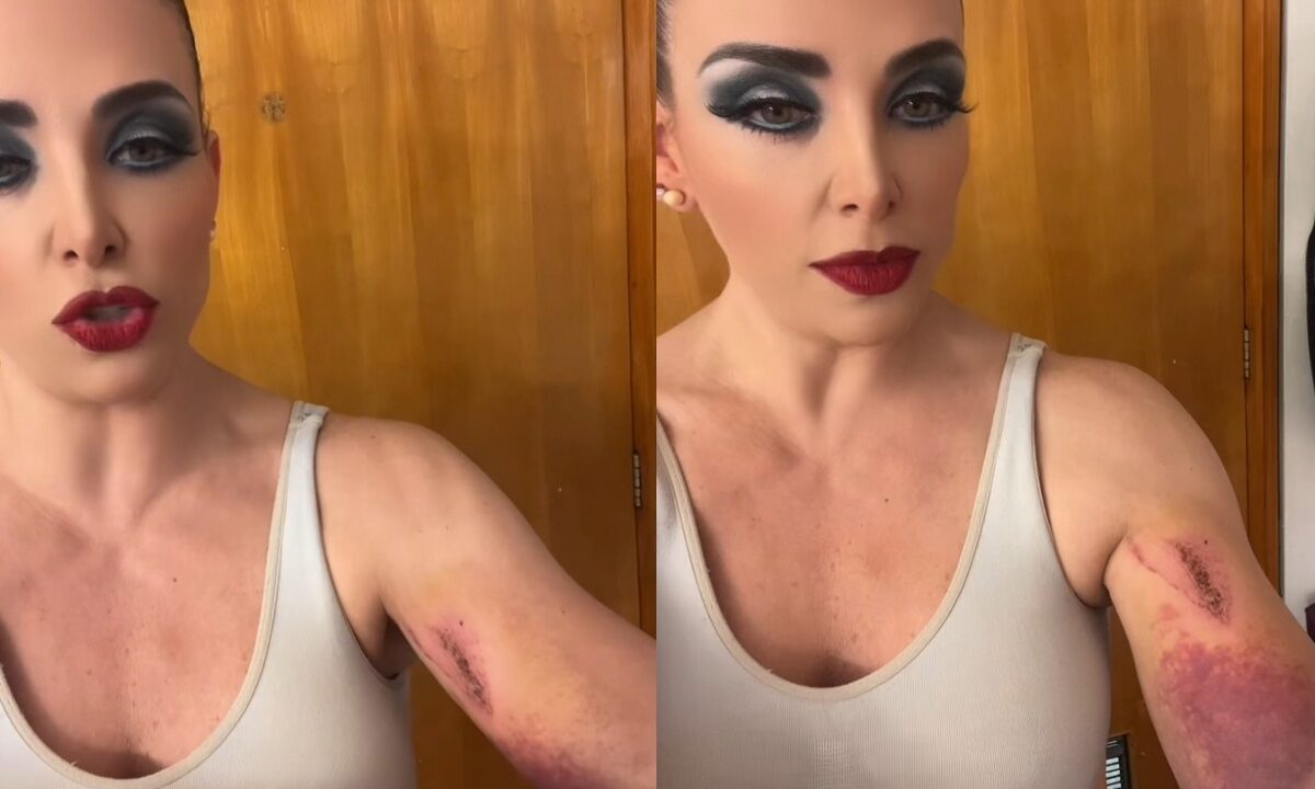 La actriz y cantante Lisset cayó a una coladera en calles de la Ciudad de México y quedó con algunas heridas que expuso en redes sociales.