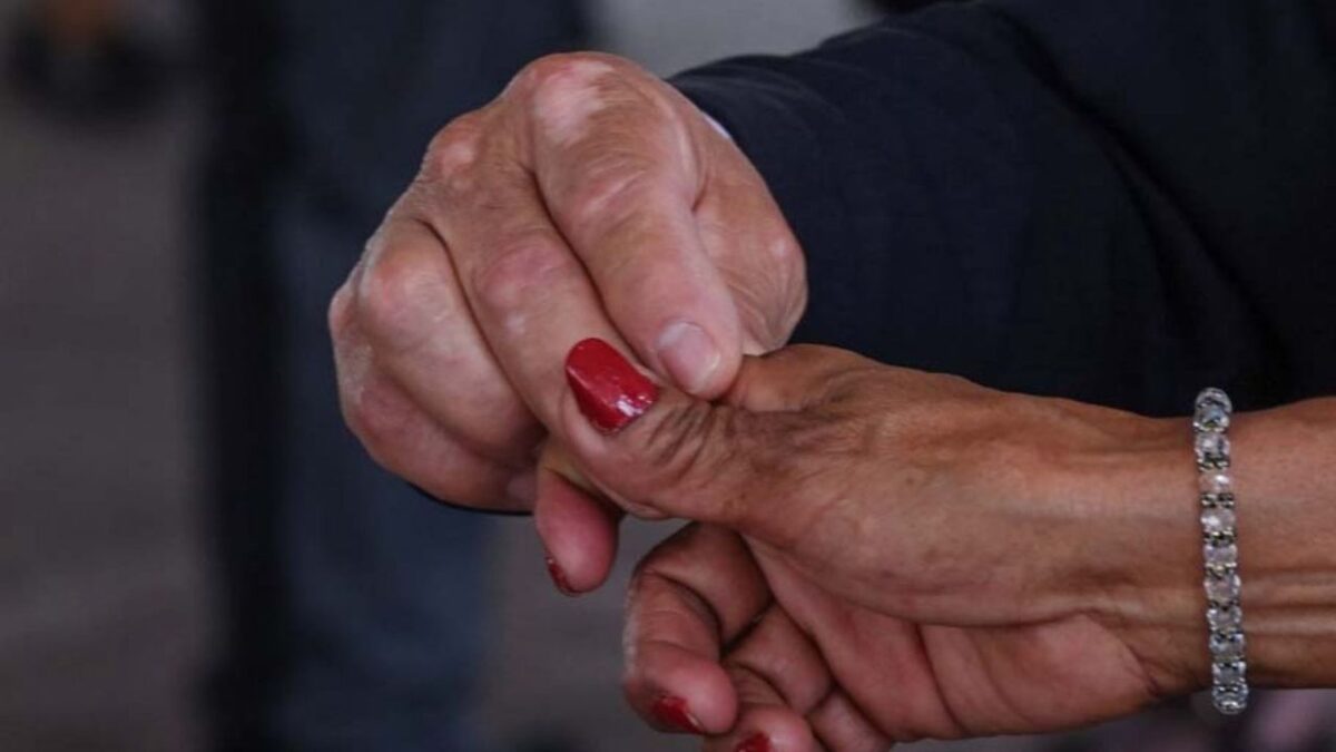 ¿Es malo tronarse los dedos de la mano? Esto es lo que sabemos