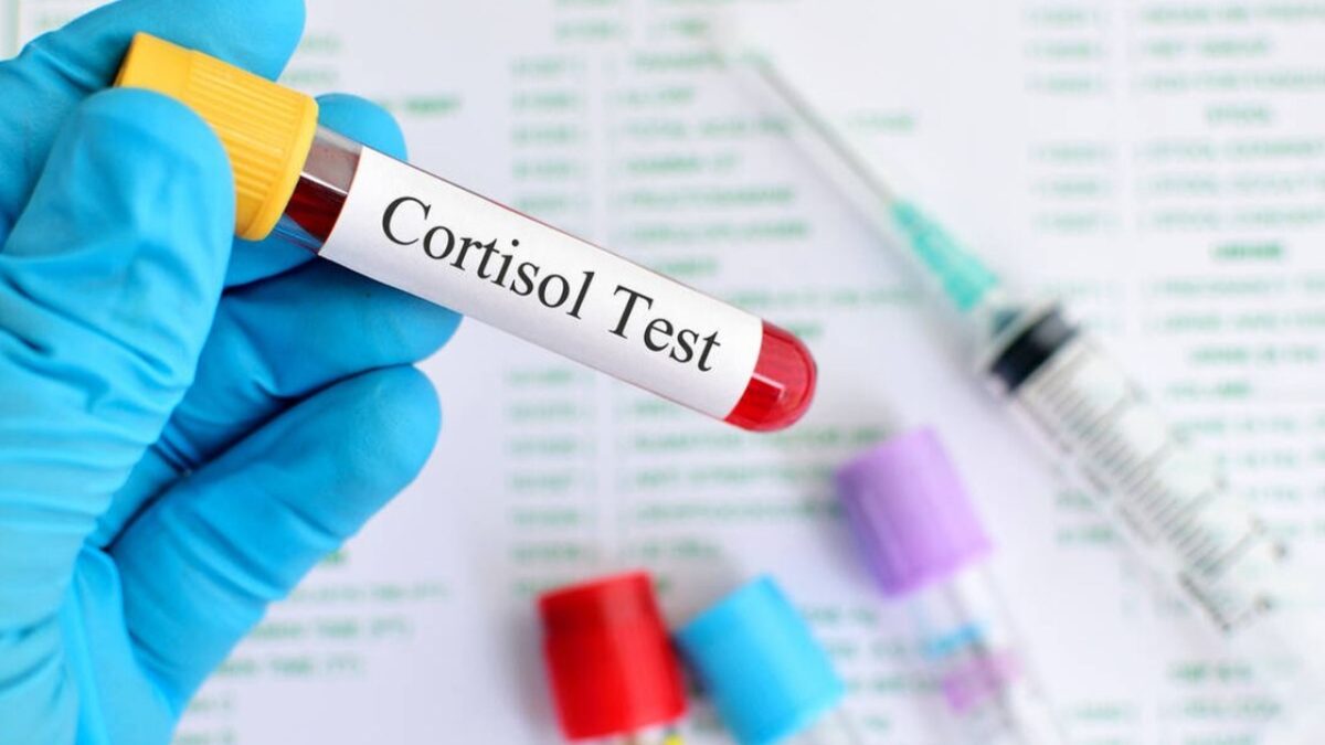 Cortisol: Esto es lo que debes saber sobre el exceso de esta hormona en la sangre