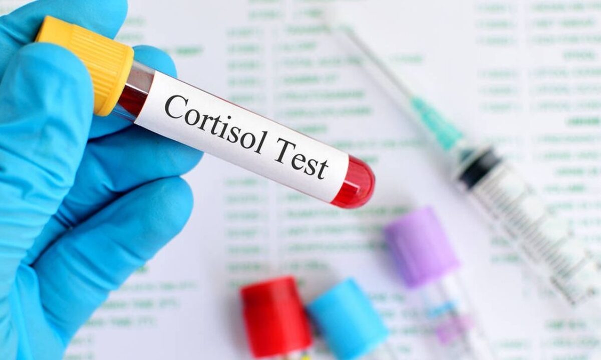 Cortisol: Esto es lo que debes saber sobre el exceso de esta hormona en la sangre