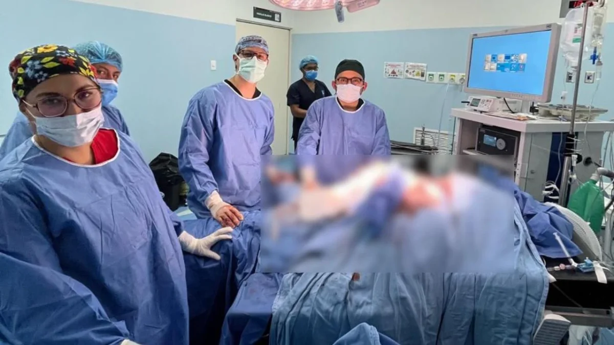 Especialistas del hospital del IMSS en Cuajimalpa realiza con éxito cirugía de remplazo de esófago.