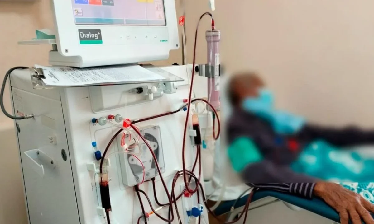 El servicio de hemodiálisis opera con normalidad en los hospitales del IMSS Bienestar