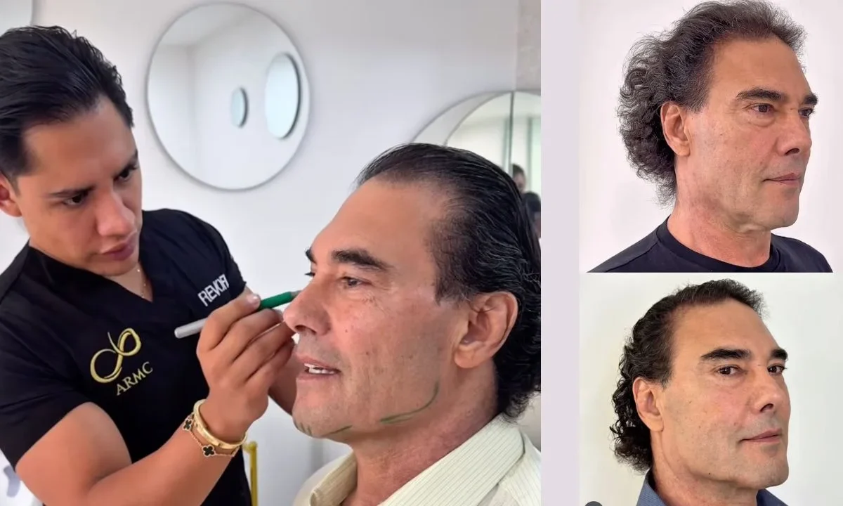 Algunos usuarios en redes sociales elogiaron el nuevo rostro de Eduardo Yañez tras someterse a tratamientos para mejorar su apariencia.